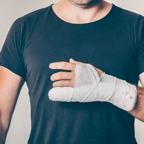 Cirugía de Fractura de Muñeca en Santa Cruz